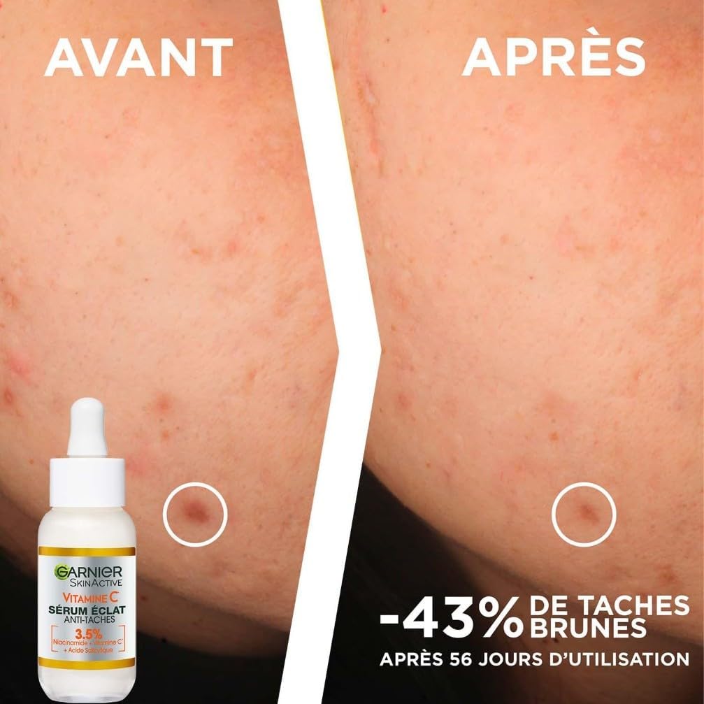GARNIER SkinActive Vitamine C - Coffret Crème Sorbet Hydratante Fresh & Bright 85ml + Sérum Jour 30ml