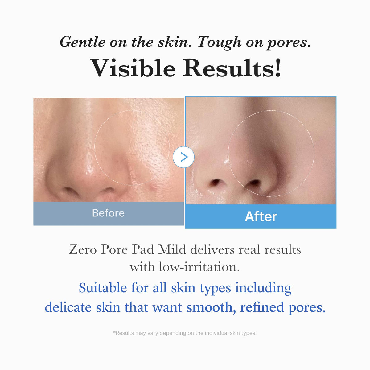 medicube Zero Pore Pad 2.0 Pads Exfoliants Soin des Pores