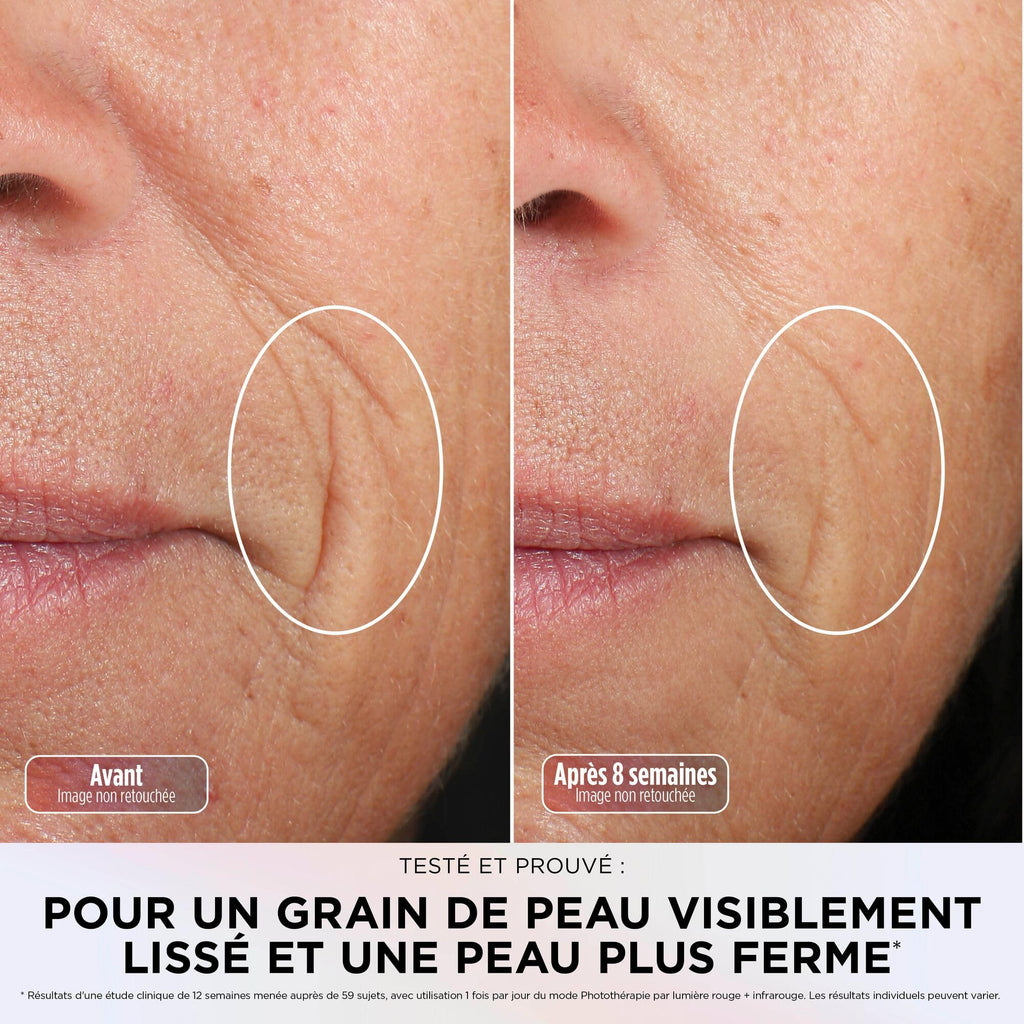 Masque LED Shark CryoGlow avec rafraîchissement du contour des yeux, LED rouge et bleue, Photothérapie par lumière infrarouge, USB-C, Télécommande, Sac de rangement, Sangles réglables