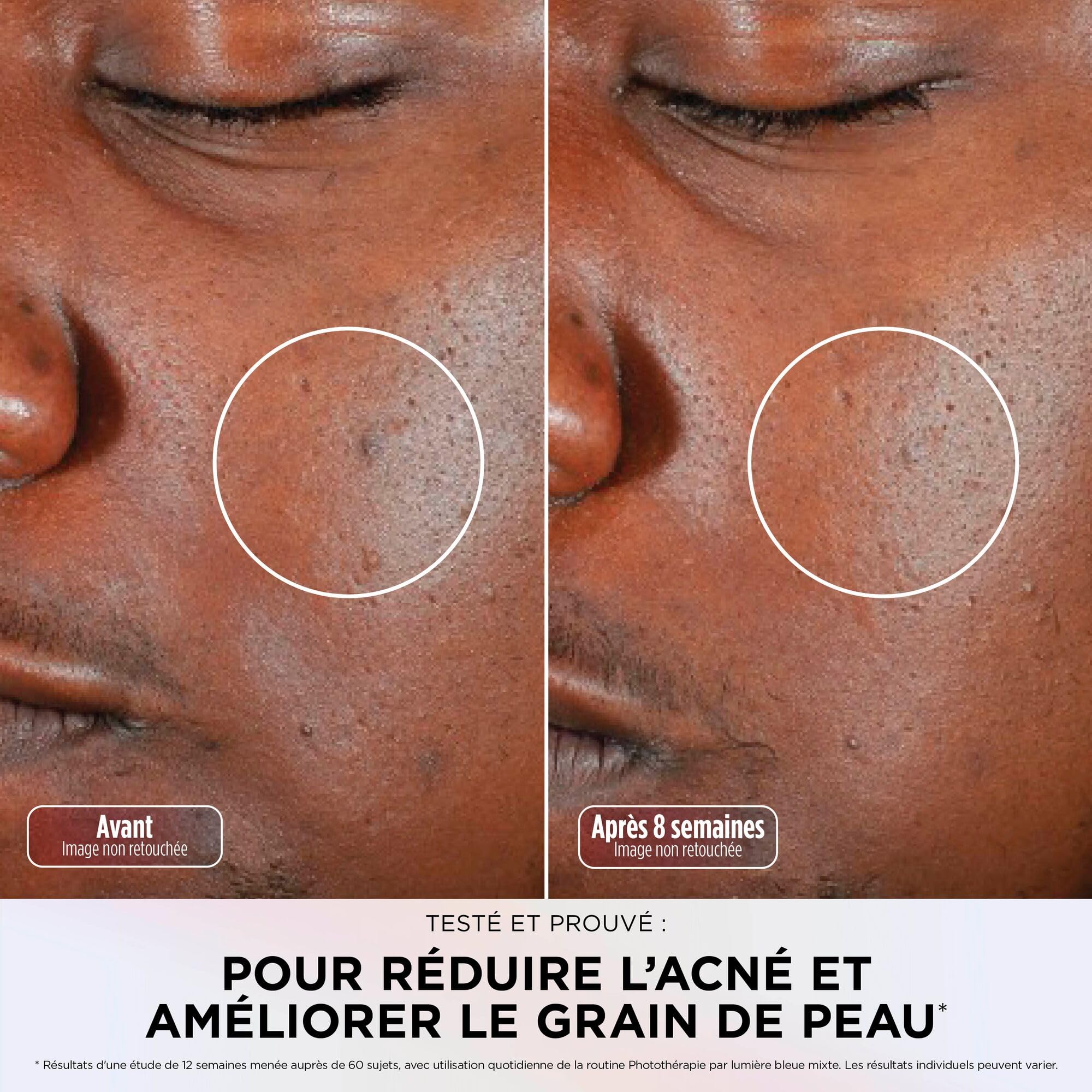 Masque LED Shark CryoGlow avec rafraîchissement du contour des yeux, LED rouge et bleue, Photothérapie par lumière infrarouge, USB-C, Télécommande, Sac de rangement, Sangles réglables